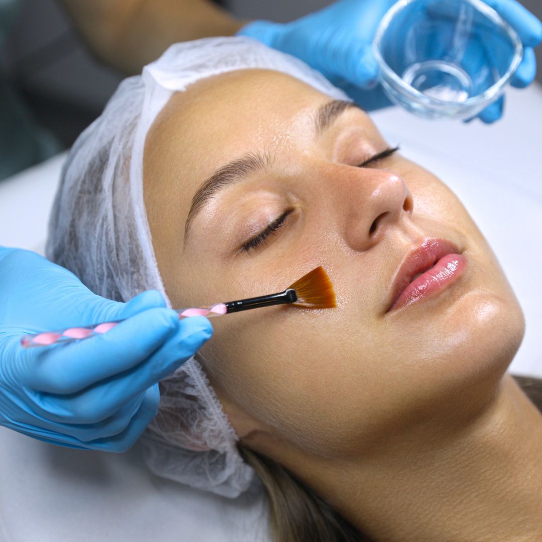 chemical peel franklin tn